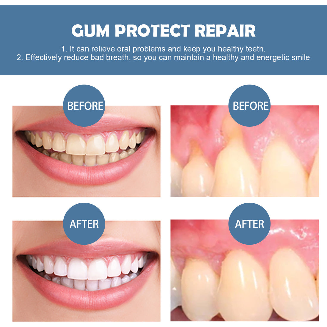 Gum Repair Series Cleans Whitens Teeth And Nurtures Oral Health Care